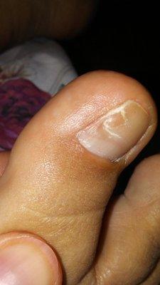 This is after 4'mos having my ingrown toe nail removed the healing isn't   improving.