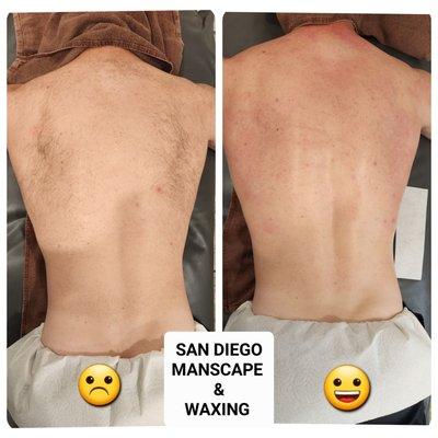 Back wax