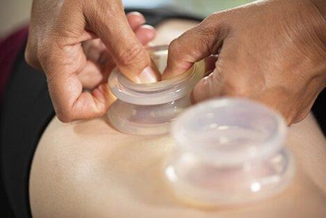 Cupping will help muscles and fascia move more freely when added to your treatment