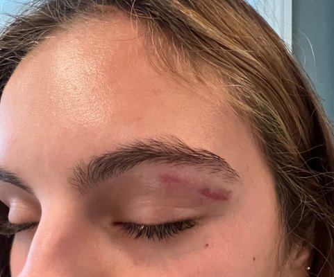 Do NOT see Kendra.   My daughter (18) went to get her eyebrows waxed and Kendra burnt her face!