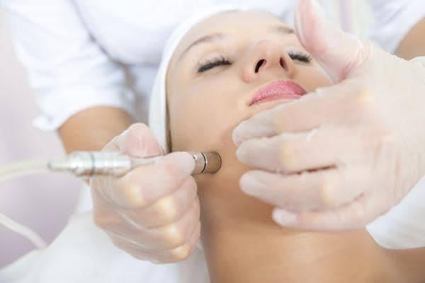 Microdermabrasion treatment.