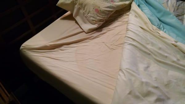 Yep, stains on the sheets.