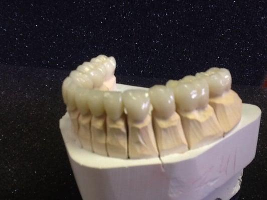 Full contoured layered porcelain.  Quality and consistent lab work. Be a part of San Antonio's elite dental lab.