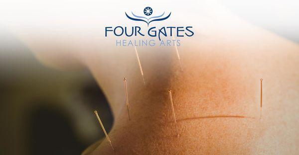 Acupuncture * Guasha * Cupping * Electro Acupuncture * Cosmetic Facial Acupuncture