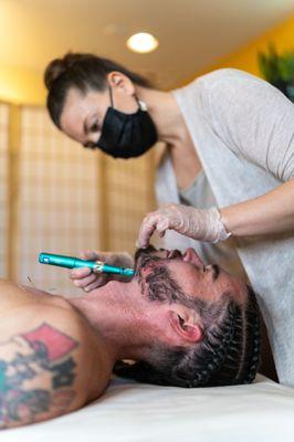 Microneedling for hair growth