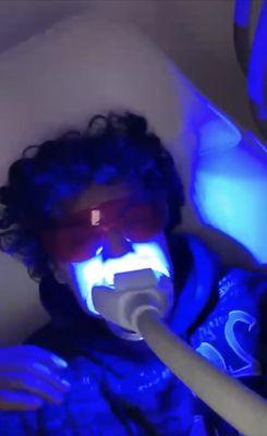 Teeth whitening