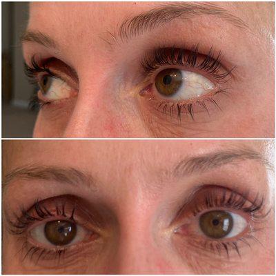 Lash Lift