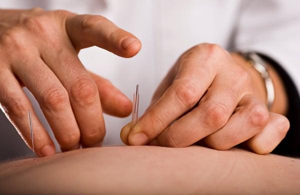 EZCD Detox Acupuncture