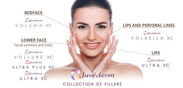 Juvederm Filler