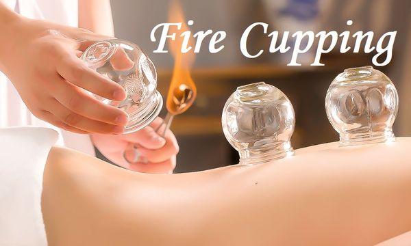 Fire Cupping Therapy to decrease pain, increasing the energy and blood circulation, to speed up the metabolism and to DETOX!