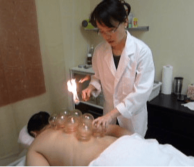 Cupping therapy for pain, inflammation, blood flow, relaxation and well-being, and as a type of deep-tissue massage.