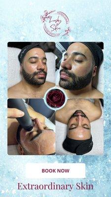 Male facial, Glo2Facial Sensitive skin