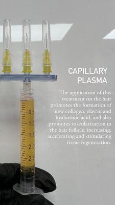 Capillary Plasma 
Call to schedule your appointment