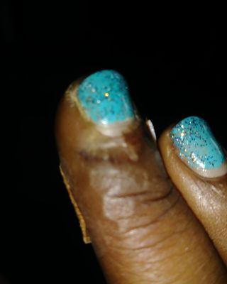 This is the result of my finger after getting a simple gel manicure from this disgusting place....my advice would be to stay away and warn o