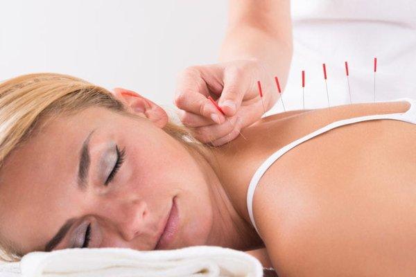 AcuWorks Acupuncture Clinic