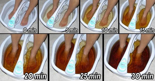 Ionic Foot Detox