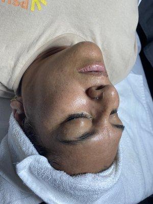 Multivitamin facial