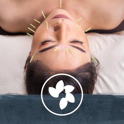 Cosmetic acupuncture and micro-needling are a natural, chemical free approach to graceful aging.