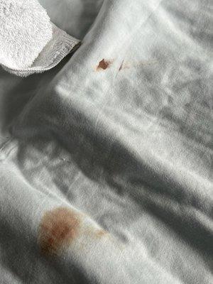 Fresh blood on the sheets. This is not a stain.