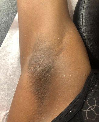 Underarm waxing done by Jeanny