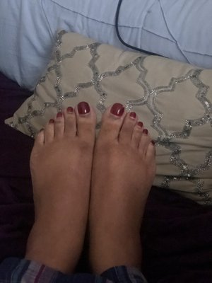 Chips in the gel polish on my pedicure after one week.