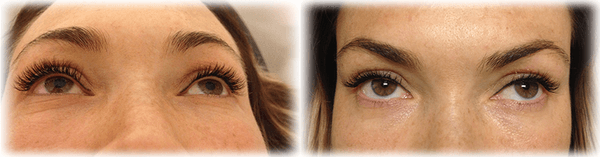 Eyelash Extension by Victoria