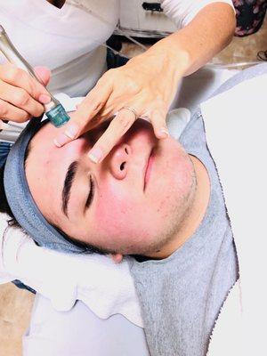 Hydrafacial