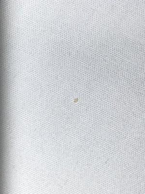 Bedbug egg