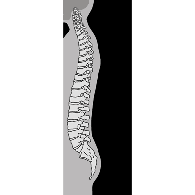 Texoma Pain & Spine Center