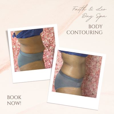 Body Contouring