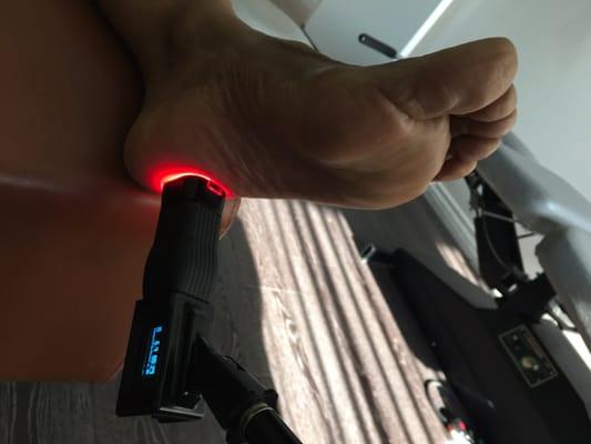 Low Level Laser Therapy Treatment for Plantar Fasciitis