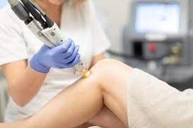 We offer Laser Hair Removal.