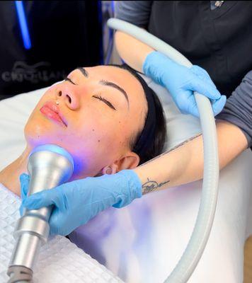 Cryofacial