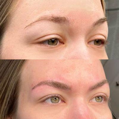 Microblading done over clients scar she hated.