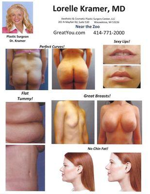 Brazilian Butt Lift, Breast Augmentation, Tummy Tuck, Kybella Injection and Lip Filler before & after photos