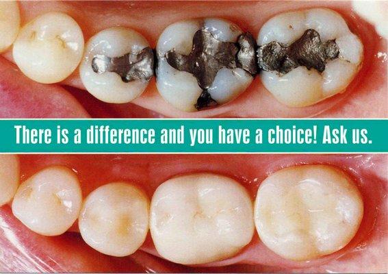 Yes, you have a choice!