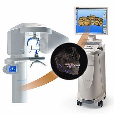 Galileos 3D Imaging System