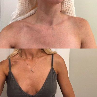 Before & after spray tan