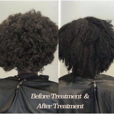 Before Treatment /after