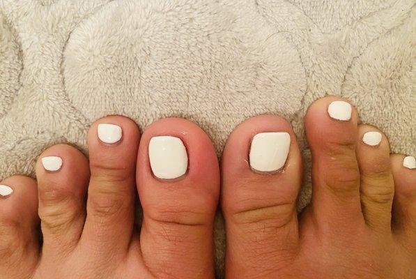 Uneven shape big toe nails