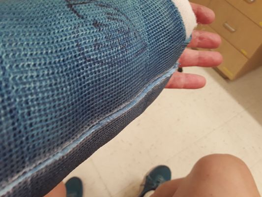 Goodbye cast!