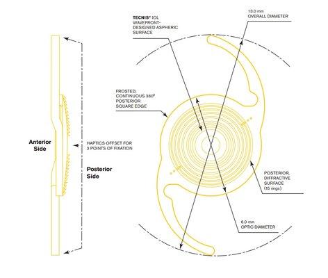 multifocal Synergy lens