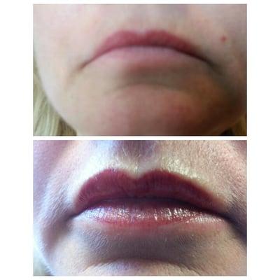 BEFORE & AFTER PERMANENT LIP COLOR