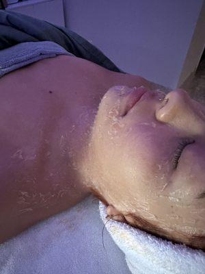 DMK Quick Peel Exfoliation