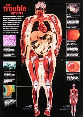 The trouble with obesity