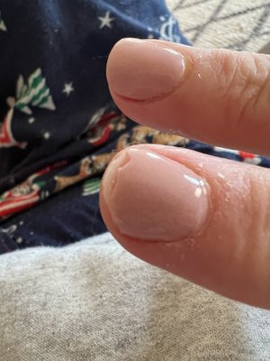 Chipped nail on right hand.