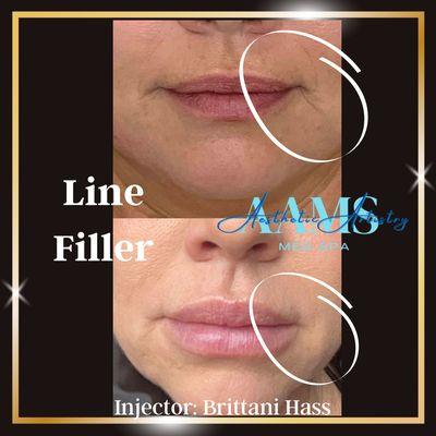 Wrinkle & line filler