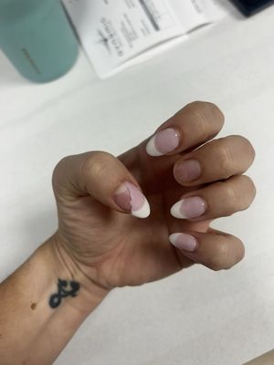 Nail gone and other chipped off.