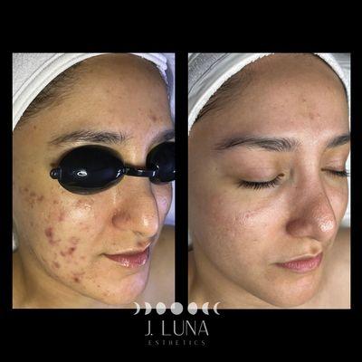 J. Luna Esthetics