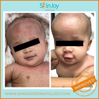 Skin Joy Dermatology accept infants/ babies less than 1 year old.